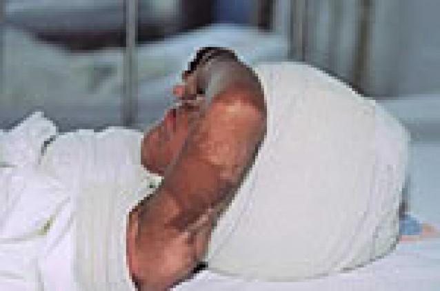 Crianças vítimas de abuso sexual têm maior risco de contrair HIV Crianças vítimas de abuso sexual têm maior risco de contrair HIV